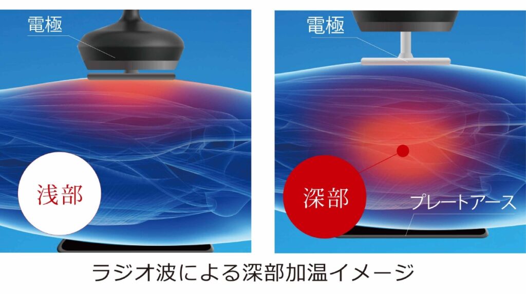 じんわり温かく、体の内側から整う新感覚の温熱ケア。